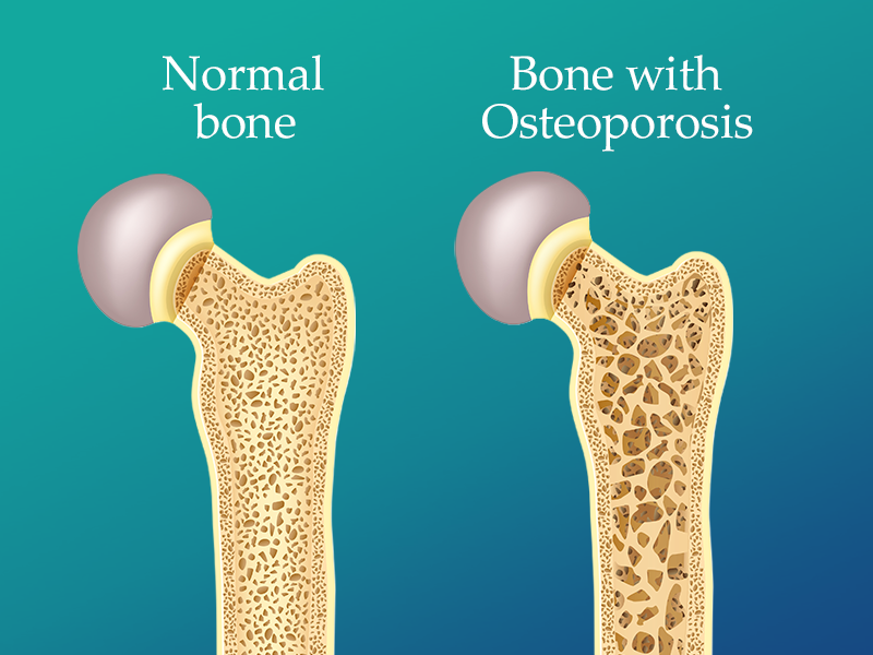 Treatments image