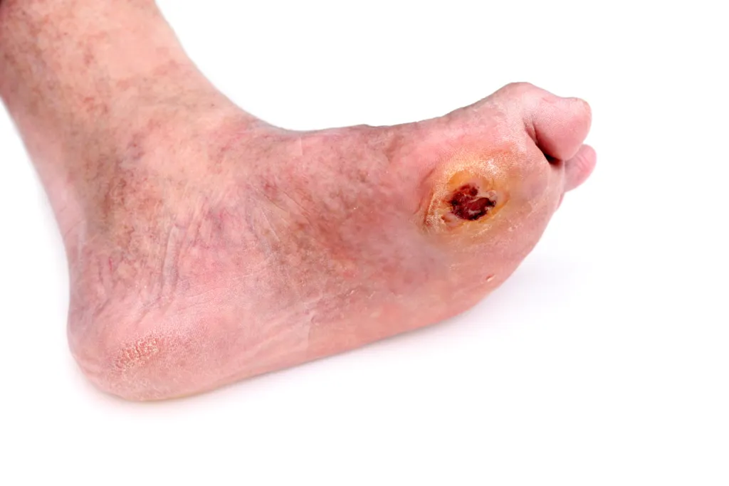 Treatments image