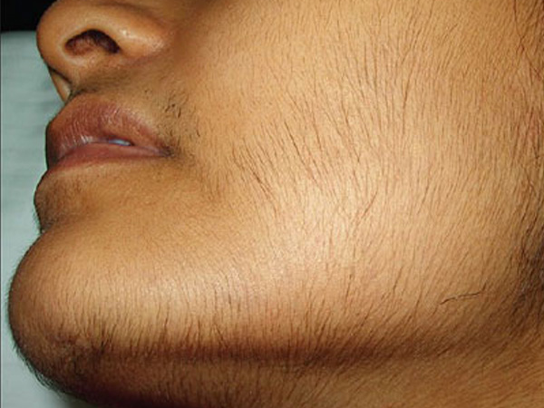 Treatments image